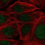 PR38A Polyclonal Antibody