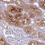PR38A Antibody in Immunohistochemistry (IHC)