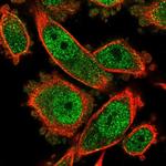 AdoHcyase 3 Polyclonal Antibody