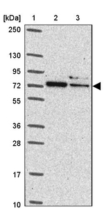 AdoHcyase 3 Antibody in Western Blot (WB)