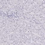 AdoHcyase 3 Antibody in Immunohistochemistry (IHC)