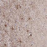 DNAL1 Antibody in Immunohistochemistry (Paraffin) (IHC (P))