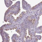 DNAL1 Antibody in Immunohistochemistry (Paraffin) (IHC (P))