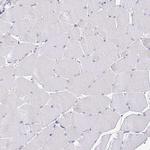 DNAL1 Antibody in Immunohistochemistry (Paraffin) (IHC (P))