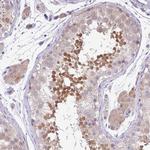 DNAL1 Antibody in Immunohistochemistry (Paraffin) (IHC (P))