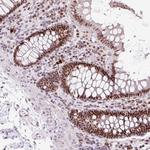 Cyclin L2 Antibody in Immunohistochemistry (Paraffin) (IHC (P))