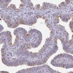 DCAF12L2 Polyclonal Antibody