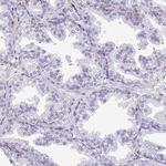 EXOSC5 Antibody in Immunohistochemistry (Paraffin) (IHC (P))
