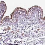 SPINK8 Polyclonal Antibody