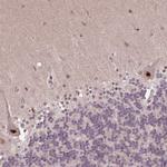 ZNF709 Antibody in Immunohistochemistry (Paraffin) (IHC (P))