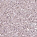 ZNF709 Antibody in Immunohistochemistry (Paraffin) (IHC (P))