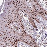ZNF709 Antibody in Immunohistochemistry (Paraffin) (IHC (P))