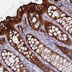 DEFB115 Antibody in Immunohistochemistry (Paraffin) (IHC (P))