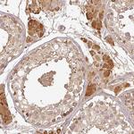 TCL1B Antibody in Immunohistochemistry (Paraffin) (IHC (P))