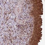 OR6B1 Antibody in Immunohistochemistry (Paraffin) (IHC (P))