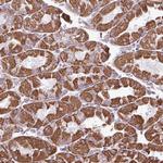 ZCCHC5 Polyclonal Antibody