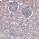 Pellino 2 Antibody in Immunohistochemistry (Paraffin) (IHC (P))