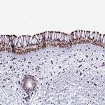 Pellino 2 Antibody in Immunohistochemistry (Paraffin) (IHC (P))