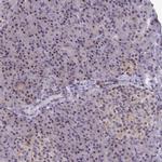 Pellino 2 Antibody in Immunohistochemistry (Paraffin) (IHC (P))