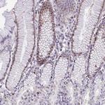 Pellino 2 Antibody in Immunohistochemistry (Paraffin) (IHC (P))