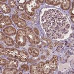 VPRBP Antibody in Immunohistochemistry (Paraffin) (IHC (P))