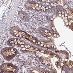 C3orf1 Antibody in Immunohistochemistry (Paraffin) (IHC (P))