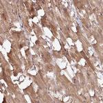 C3orf1 Antibody in Immunohistochemistry (Paraffin) (IHC (P))