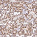 C3orf1 Antibody in Immunohistochemistry (Paraffin) (IHC (P))