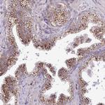 C3orf1 Antibody in Immunohistochemistry (Paraffin) (IHC (P))