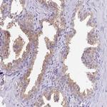FAM177A1 Antibody in Immunohistochemistry (Paraffin) (IHC (P))