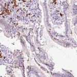 PR38B Antibody in Immunohistochemistry (Paraffin) (IHC (P))