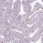 PR38B Antibody in Immunohistochemistry (Paraffin) (IHC (P))