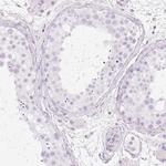 PR38B Polyclonal Antibody