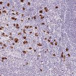 PR38B Antibody in Immunohistochemistry (Paraffin) (IHC (P))