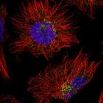 AGPAT4 Polyclonal Antibody