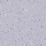 ABCB4 Antibody in Immunohistochemistry (Paraffin) (IHC (P))
