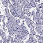 ABCB4 Polyclonal Antibody