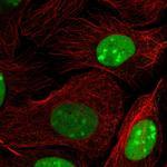 HMGB2 Polyclonal Antibody