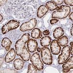 KCTD19 Polyclonal Antibody