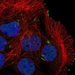 Calpain 12 Polyclonal Antibody