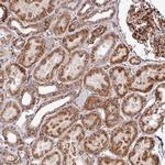 FAM47E Antibody in Immunohistochemistry (Paraffin) (IHC (P))