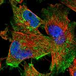 FAM47E Polyclonal Antibody