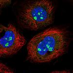 CFAP97 Polyclonal Antibody