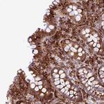 CFAP97 Antibody in Immunohistochemistry (Paraffin) (IHC (P))