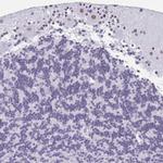 DCAF17 Antibody in Immunohistochemistry (Paraffin) (IHC (P))