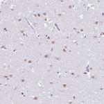 DCAF17 Polyclonal Antibody