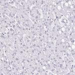 DCAF17 Antibody in Immunohistochemistry (Paraffin) (IHC (P))