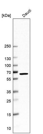 DCAF17 Antibody in Western Blot (WB)