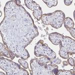 RhoV Antibody in Immunohistochemistry (Paraffin) (IHC (P))