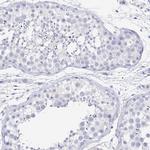 RhoV Antibody in Immunohistochemistry (Paraffin) (IHC (P))